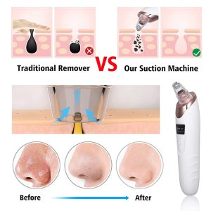 Electric Blackhead Suction Device - Image 4