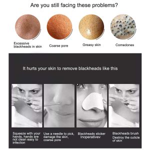 Electric Blackhead Suction Device - Image 7